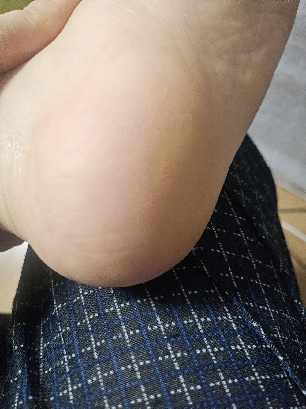 커먼하우스 만능 발각질제거기 구매 후기 이미지